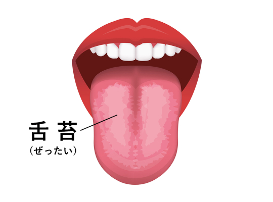 画像：舌苔の説明